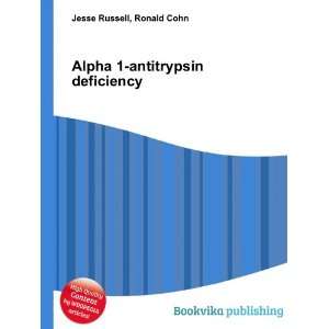 Alpha 1 antitrypsin deficiency Ronald Cohn Jesse Russell  