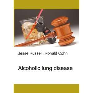 Alcoholic lung disease Ronald Cohn Jesse Russell  Books