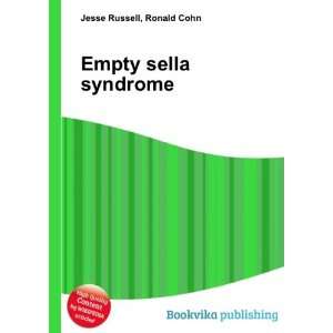  Empty sella syndrome Ronald Cohn Jesse Russell Books
