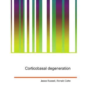  Corticobasal degeneration Ronald Cohn Jesse Russell 