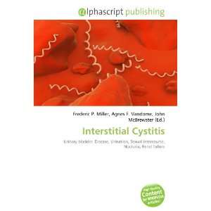  Interstitial Cystitis (9786134011402) Books