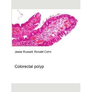  Colorectal polyp Ronald Cohn Jesse Russell Books